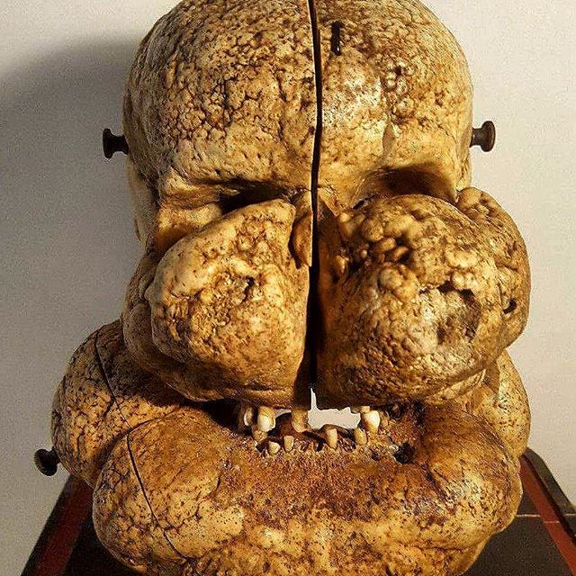 Crânes humain et divers Real Human Skulls Skull for sale 16230612