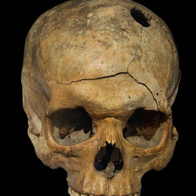 Crânes humain et divers Real Human Skulls Skull for sale 16585611
