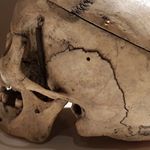 Crânes humain et divers Real Human Skulls Skull for sale 18161910