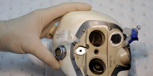 Carmat implante pour la première fois un cœur artificiel à l'hôpital Georges-Pompidou à Paris Le-pre14