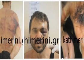 Ja si u torturua Ilia Kareli në burgun grek, VIDEOJA DOKUMENTUESE Model-10