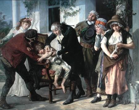 inoculation - La petite vérole (variole) : L'inoculation de la famille royale Edward10