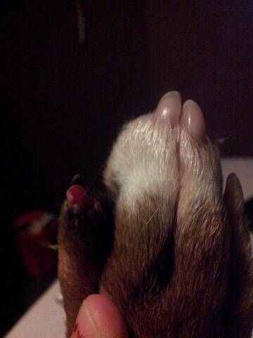 Ongle Arrache Nerf A Vif Ongle Arrache Nerf A Vif