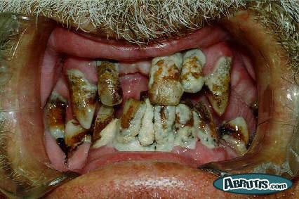 Commande groupée de Dentifrice MARVIS - Juste pour savoir qui serait IN - Page 4 Dents10