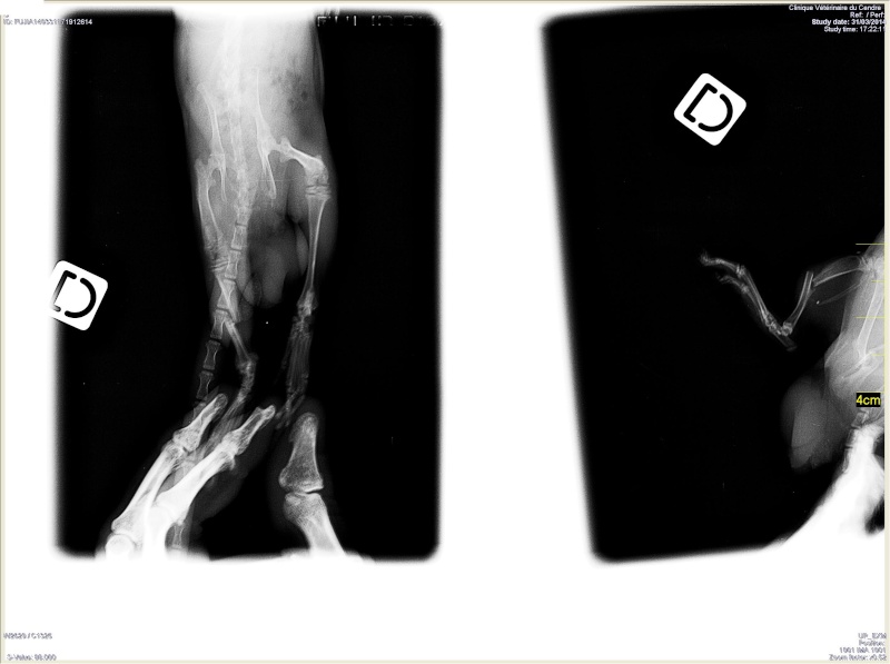 Fracture, quelle(s) solution(s) ? Malbet10