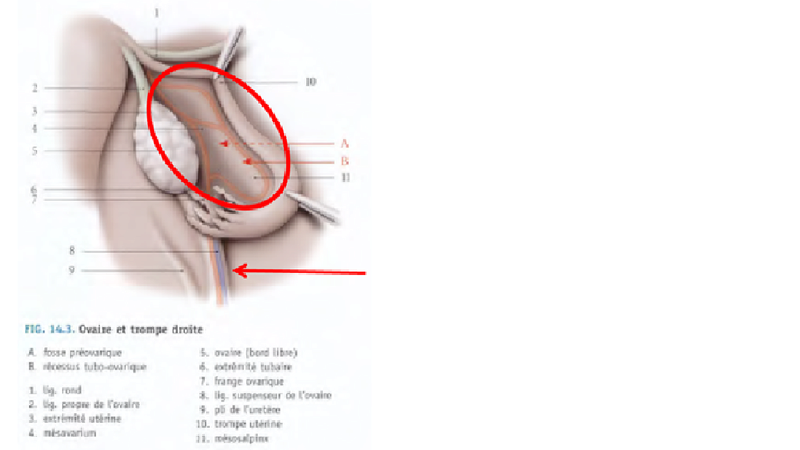 ligament suspenseur de l'ovaire et mésocarium Ovaire11