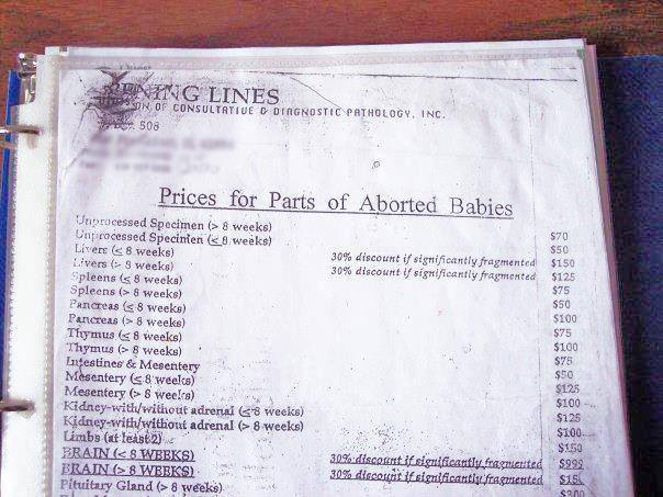 Prices of aborted baby parts and the company's that use them Img_4810