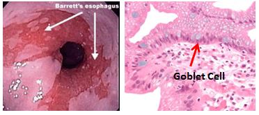 Esophagus High Yield 117