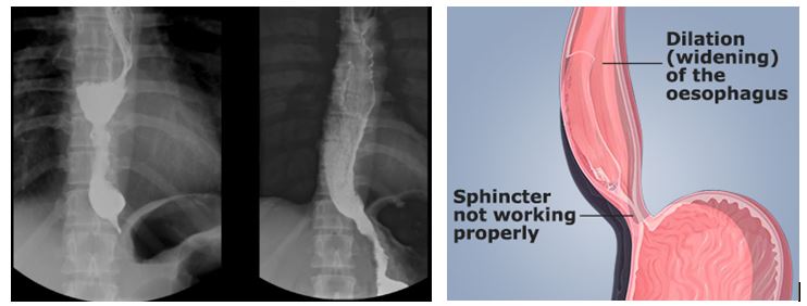 Esophagus High Yield 118