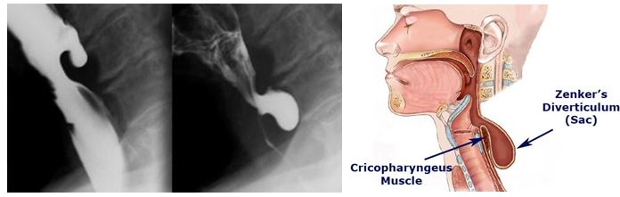 Esophagus High Yield 119