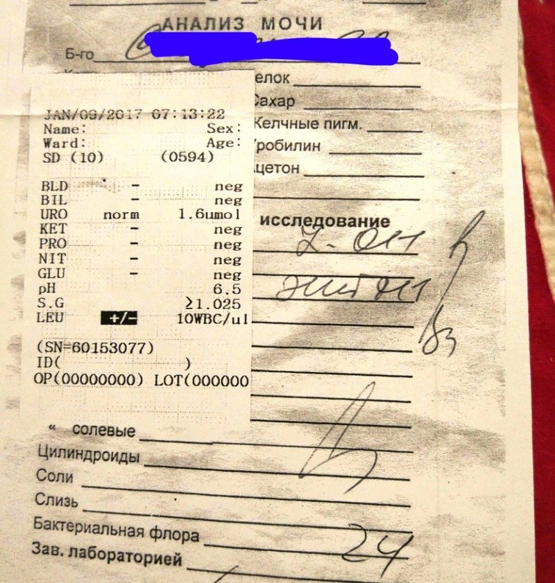 Саркоидоз или ЛГМ с метастазами? I10