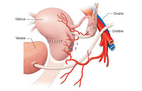 Croisement uretere / artere ovarienne  Imgres10