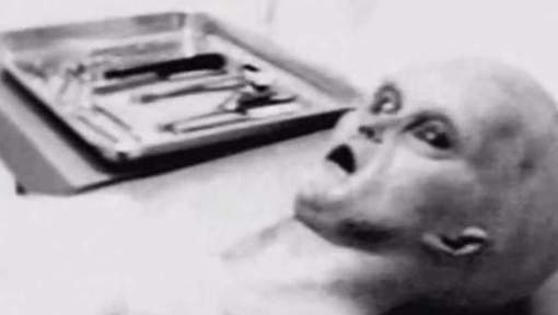 Cette photo d'autopsie d'extraterrestre est-elle authentique? Media_10