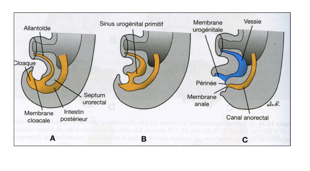 Sinus urogénital Captur65