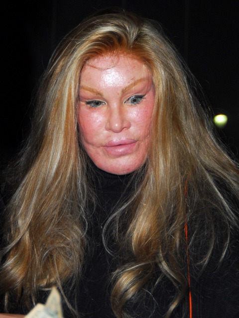 L'ossessione di essere perfetti: Jocelyn Wildenstein Jocely10