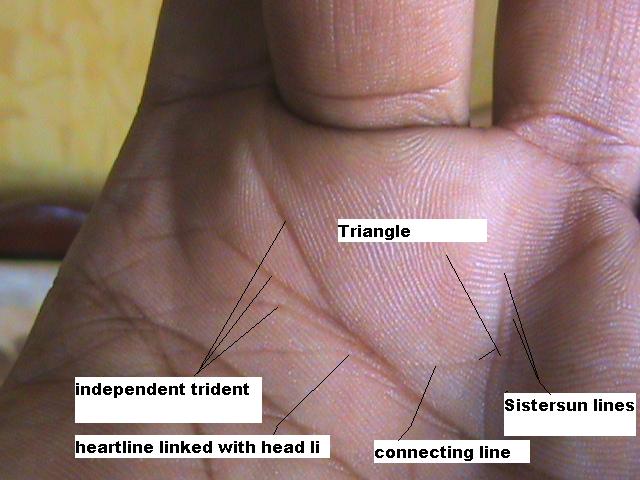 VII - REPORT: Korean researchers discovered the 'Suwon crease', only observed in males! - Page 9 Dsc00128