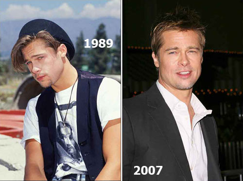 Celebrities: THEN and NOW Thenno10