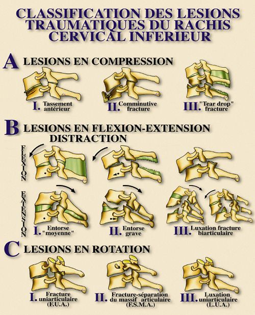classifications en orthopédie-traumatologie  Poster10