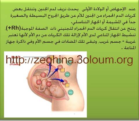 اختلاف فصيلة دم الزوجين ماهو الحل إذا كانت الزوجة تحمل عامل ريزوس سالب