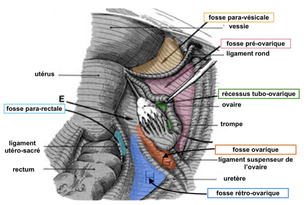 Limite du recessus tube ovarique  Captur18