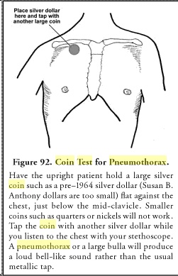 Two forgotten signs in pneumothorax Coin_t10