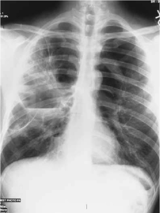 Radiology Quiz Xray1_10