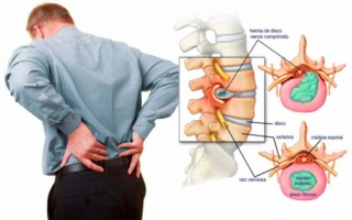 Dolor Lumbar Dolor-11