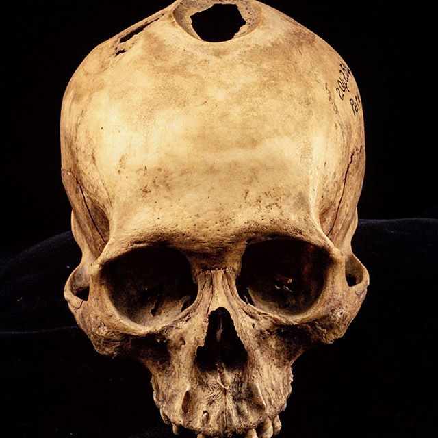 Crânes humain et divers Real Human Skulls Skull for sale 16123410