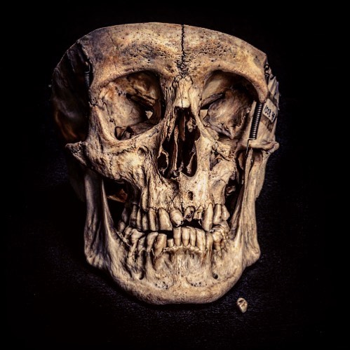 Crânes humain et divers Real Human Skulls Skull for sale 16583110