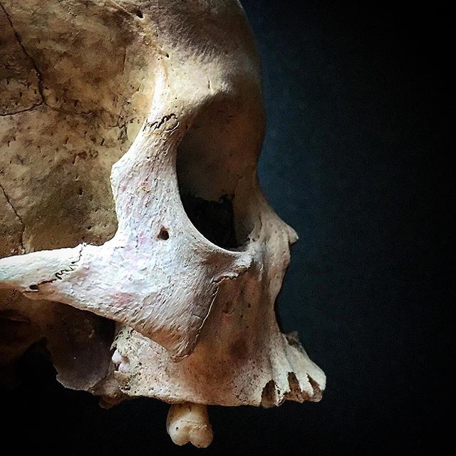 Crânes humain et divers Real Human Skulls Skull for sale 18380010
