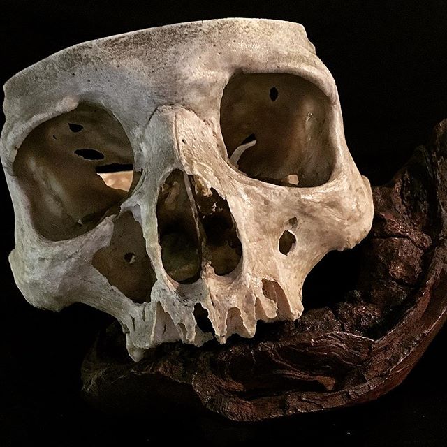 Crânes humain et divers Real Human Skulls Skull for sale 18381810
