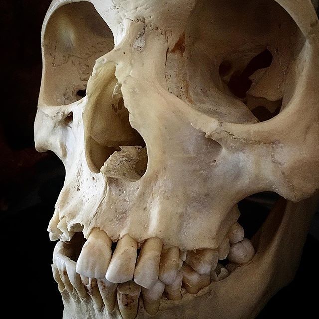 Crânes humain et divers Real Human Skulls Skull for sale 18579510