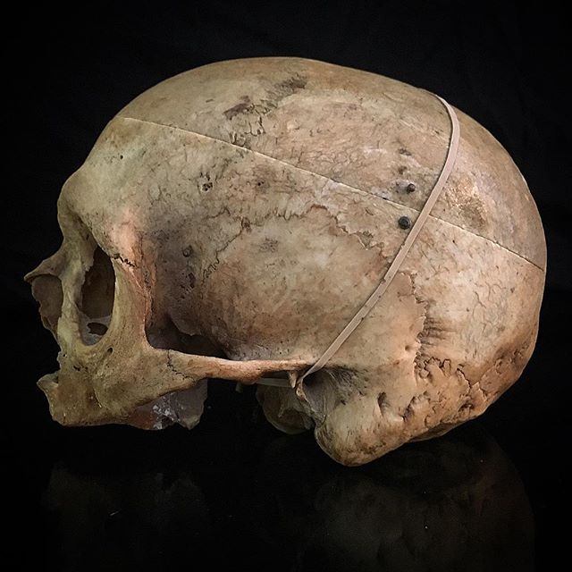 Crânes humain et divers Real Human Skulls Skull for sale 20589810