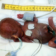 9oz Miracle: World's Smallest Ever Baby Boy 15567810