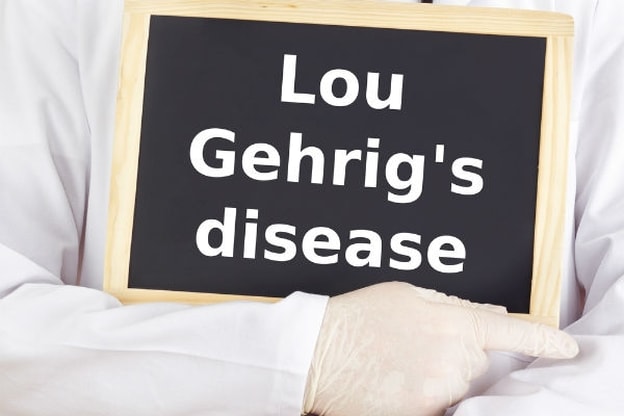 مرض شاركو Lou Gehrig's Disease 10851912