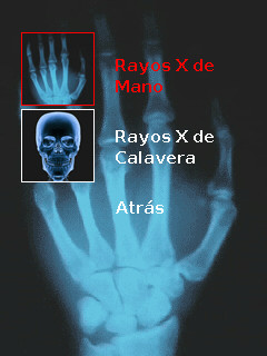 [JAVA] X-RAY Rayos x Xray1y10