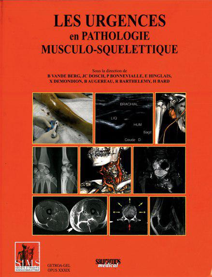 pathologie - les urgences en pathologie musculo-squelettique Photo_17