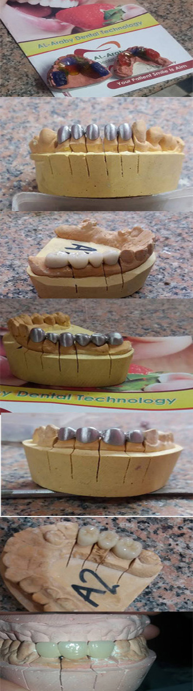 AL-araby Dental Technology معمل العربي - البوابة 215