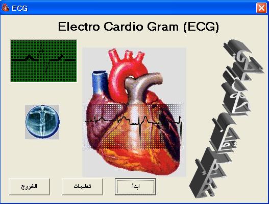 برنامج ecg رائع غني بالحالات الطبية............. Ecg10