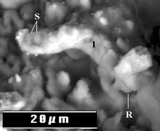 Bactéries extraterrestres dans les météorites  Bacter10
