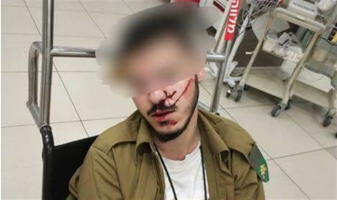 Israel National News - 2 IDF soldiers arrested after Druze serviceman brutally beaten Img80511