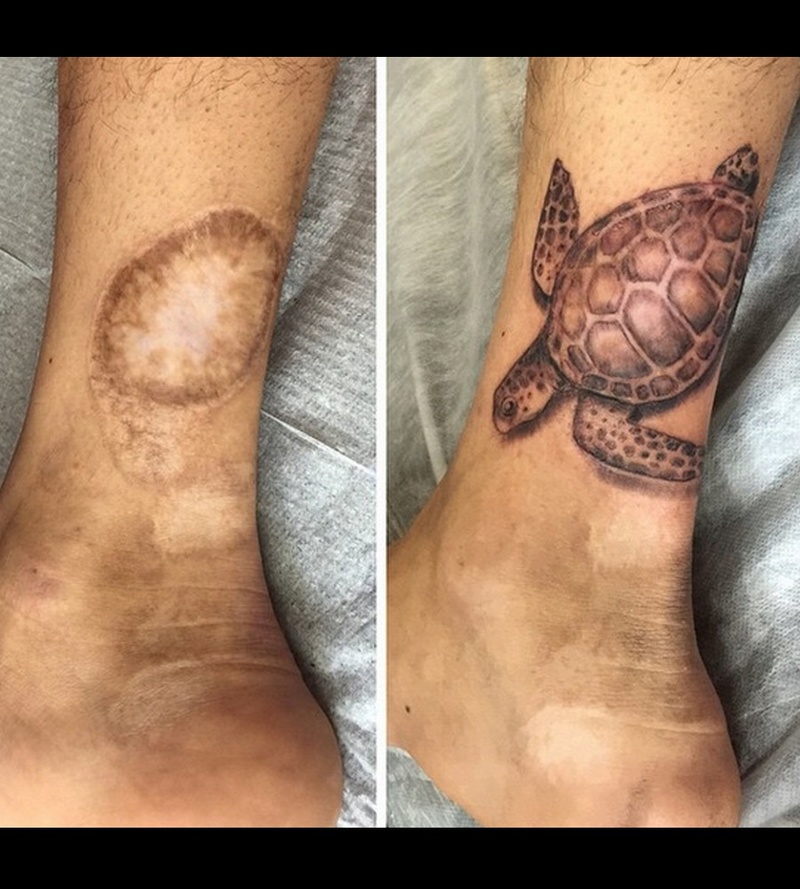 10 magnifiques tatouages pour dissimuler les cicatrices 717