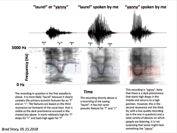 Laurel o Yanny? La nuova sfida virale che fa impazzire Internet Brad-s10