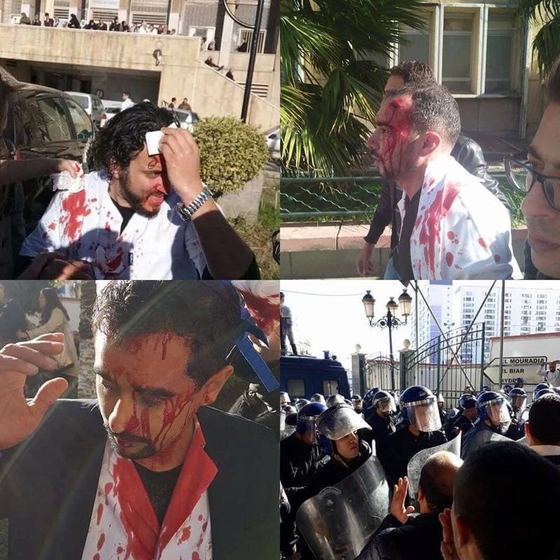 médecins résidents violemment agressés par la police le mercredi 03 janvier 2018 à Alger - Page 2 134