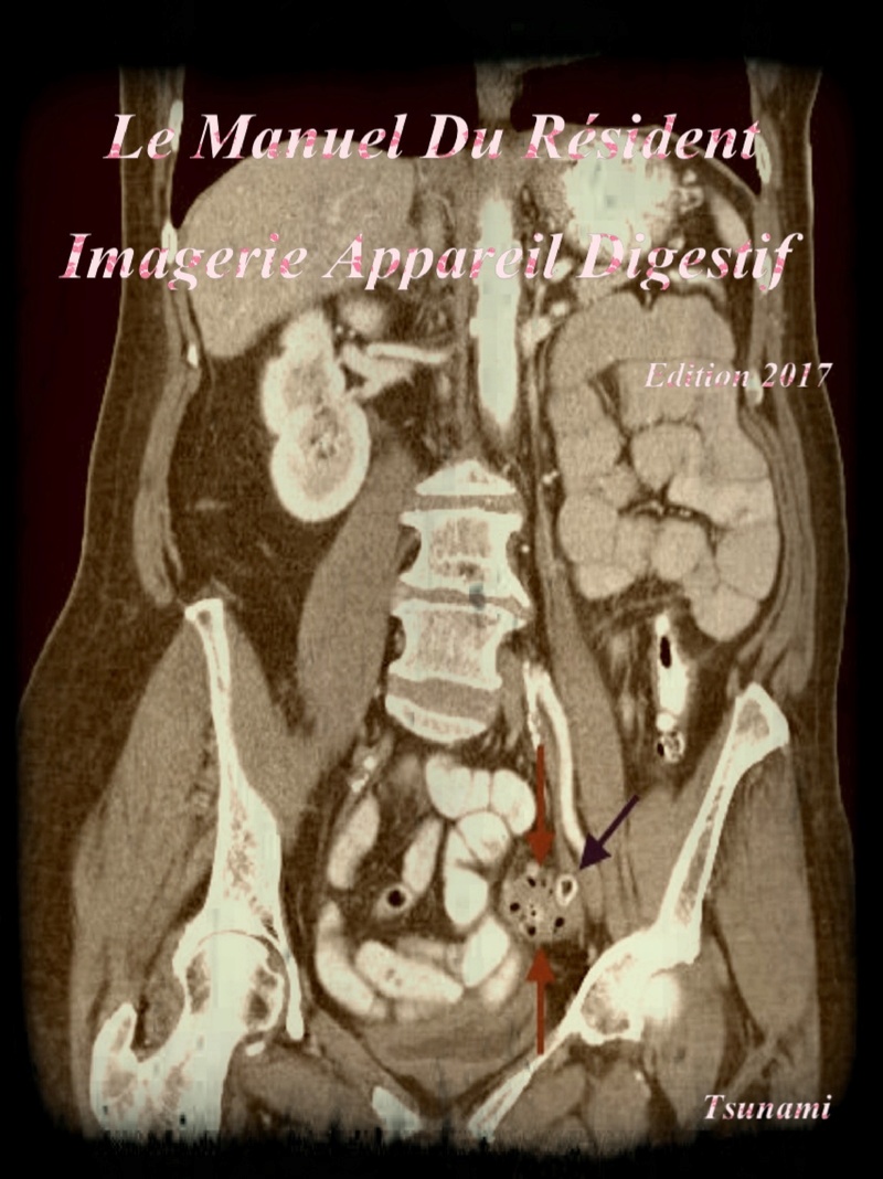 Livres Médicales - Le Manuel Du Résident 2017 - Imagerie Appareil Digestif - Page 4 Le_man10