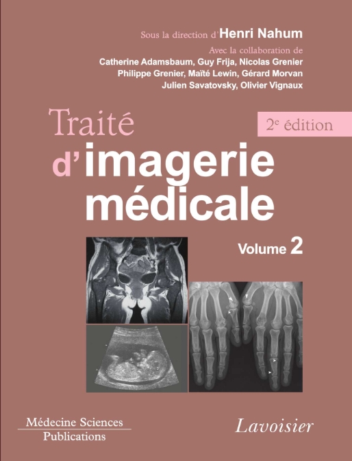 Livres Médicales - Traité d'imagerie médicale : Volume 2 Appareil urogénital, os et articulations, radiopédiatrie - Page 4 Traity11