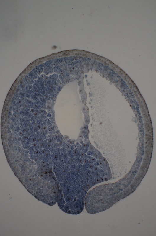 Desarrollo embrionario de la rana Embrio15