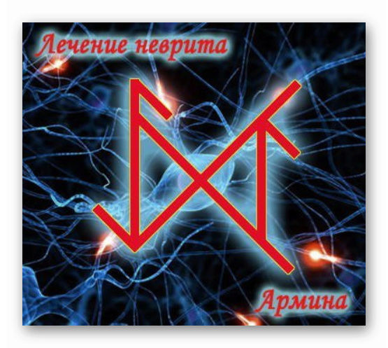 Став "Лечение неврита" Автор Армина   Ashamp12