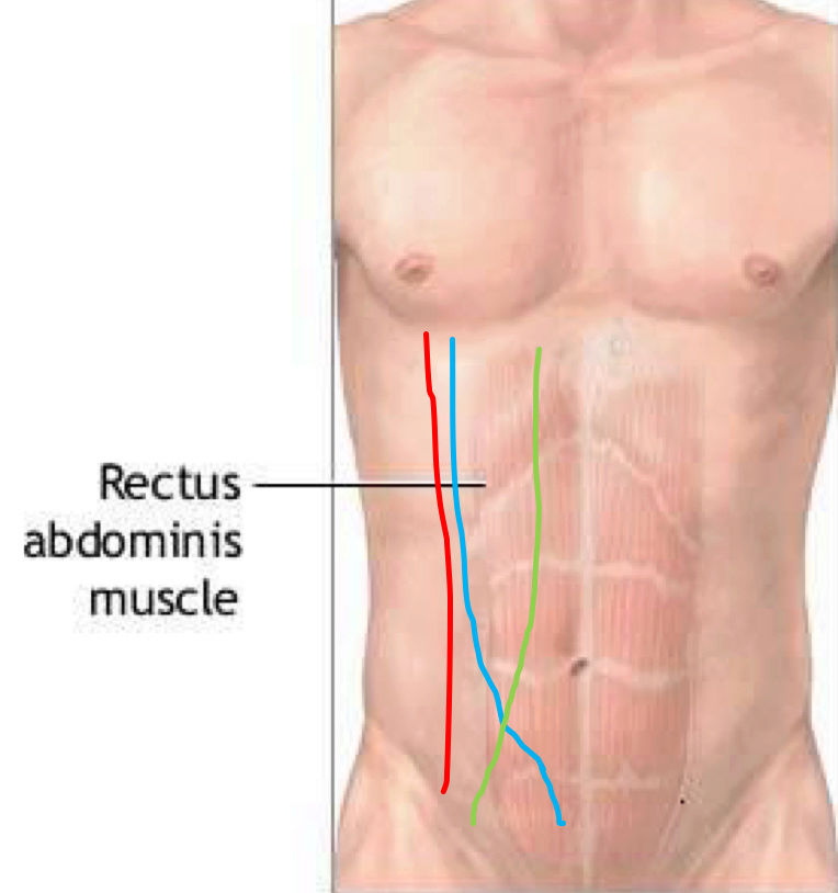 Ligne de Spieghel - Paroie Abdominale  Ddd10