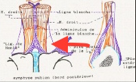 ligament de Henlé, muscle pyramidal, piliers Paroi-10